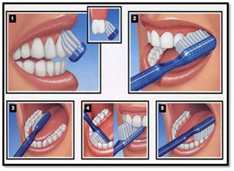 Tooth Brushing Tips-How, when and with what tooth brush?Tooth Brushing Tips-How, when and with ...