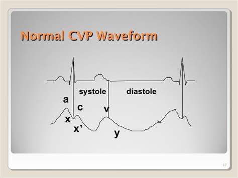 Cvp central venous pressure monitoring