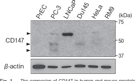 Figure From The Downregulation Of The Expression Of Cd By Tumor