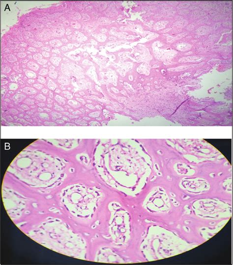 Histopathological Sections Hematoxylin And Eosin Stain Showing