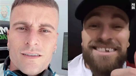 Foto O Jogador De Futebol Lucas Lima Exibe Dente Sem Lente De Contato