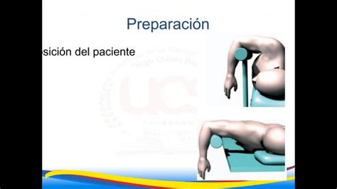 Osteos Ntesis De Fractura De Humero Distal Pptx