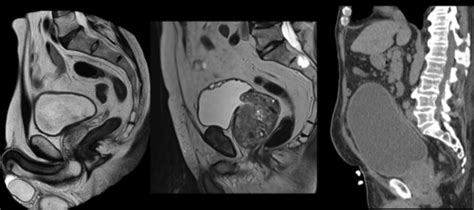 Urology Imaging Clin Lab Flashcards Quizlet