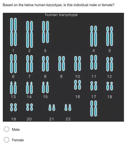 Solved Based on the below human karyotype, is this | Chegg.com