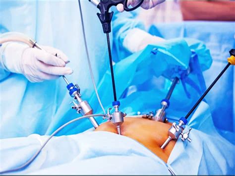 Advanced Laparoscopic Surgeries Srishtifertility