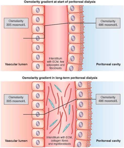 Frontiers Aging Of The Peritoneal Dialysis Membrane