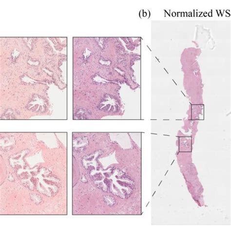 Stain Normalization Process For A Prostate Wsi Original Slide A And