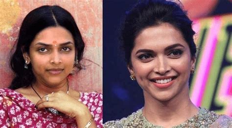 Deepika Padukone Picture Before And After Plastic Surgery Plastic