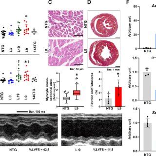 Establishment of αMHC miR 143 145TG mice a Structure of the injected