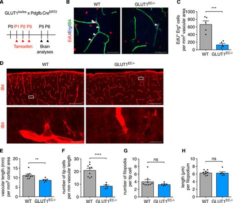 Role Of The Glut Glucose Transporter In Postnatal Cns Angiogenesis And