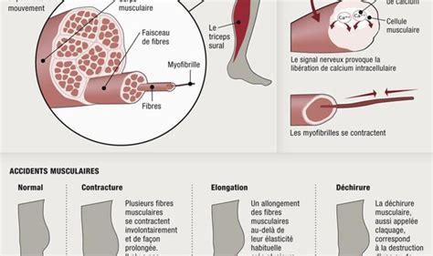 Comment accélérer le processus de guérison d une déchirure musculaire