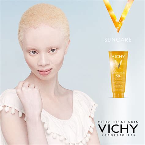 Thando Hopa Mannequin Albinos Est La Nouvelle égérie De Vichy