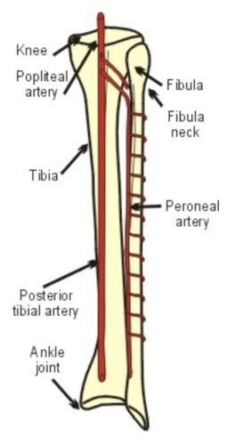 MS11 Bone Grafting Reconstruction Flashcards Quizlet