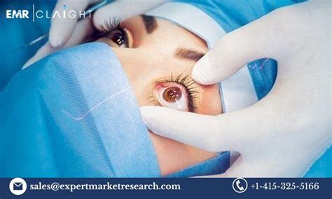 Glaucoma Surgery Devices Market Size Share Price Trends