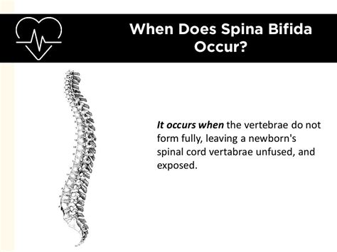 Spina Bifida Birth Defects: Possible Causes of Congenital Injuries Ex…