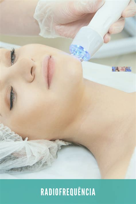 Radiofrequ Ncia Aparelhos E Marcas Radiofrequ Ncia Est Tica Facial