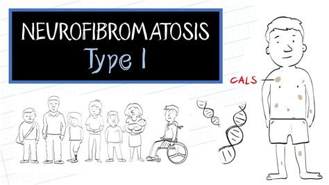 Neurofibromatosis Type 2 Gene