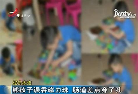 危險的玩具 看起來像巧克力豆 7歲男童誤吞差點腸穿孔 每日頭條