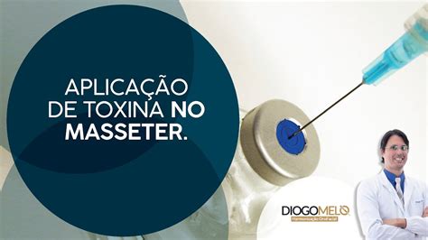 Aplicação De Toxina Botulínica No Músculo Masseter Youtube