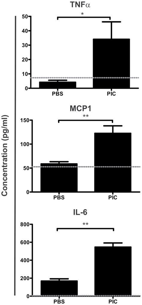 Tnfα Mcp 1 And Il 6 Concentration Was Assessed In Serum After 3h Of Download Scientific