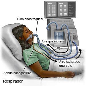 Respirador Care Guide Information En Espanol