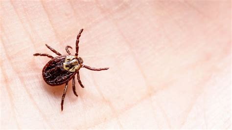 Lyme Disease Can Be Diagnosed By Bulls Eye Rash Alone Bbc News