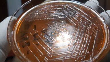 Proteus vulgaris- Introduction, Morphology, Pathogenicity, Lab Diagnosis