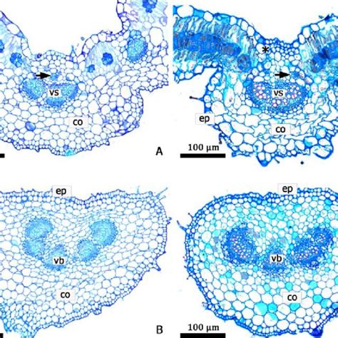 Cross Section Of Midrib And Petiole In Allionia Incarnata 5a B