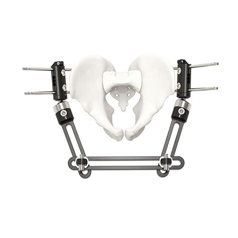 Surgical Orthofix Pelvic Three Section Typeexternal Fixators