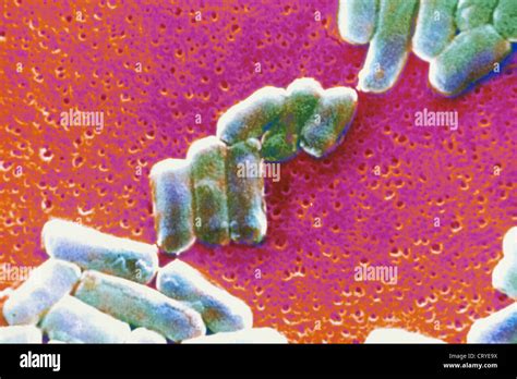 Clostridium Perfringens Bacteria Hi Res Stock Photography And Images