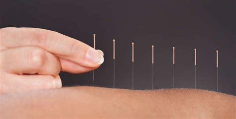 Trigger Point Dry Needling Vs Acupuncture What S The Difference