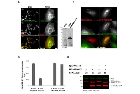 The ABD Of FLNa Is Targeted To Proteasomal Degradation By ASB2 A A