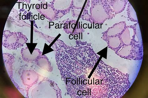 Thyroid Gland Histology