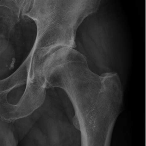 Preoperative MRI Of A 61 Years Old Male Patient A Axial Sequence Of