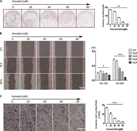 Frontiers Honokiol Inhibits Proliferation Invasion And Induces