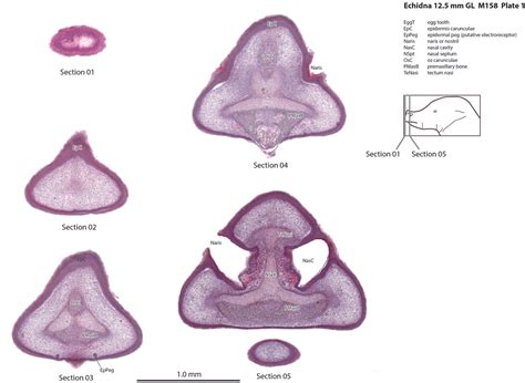 Echidna 12.5 mm GL (prehatching) — Comparative Brain Anatomy