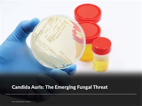 Candida Auris The Emerging Fungal Threat