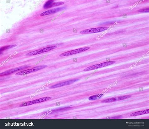 Smooth Muscle Fibers Longitudinally Sectioned These Stock Photo