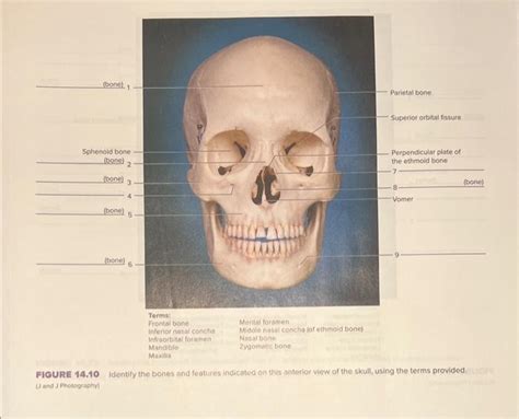 Solved Figure Identify The Bones And Features Chegg