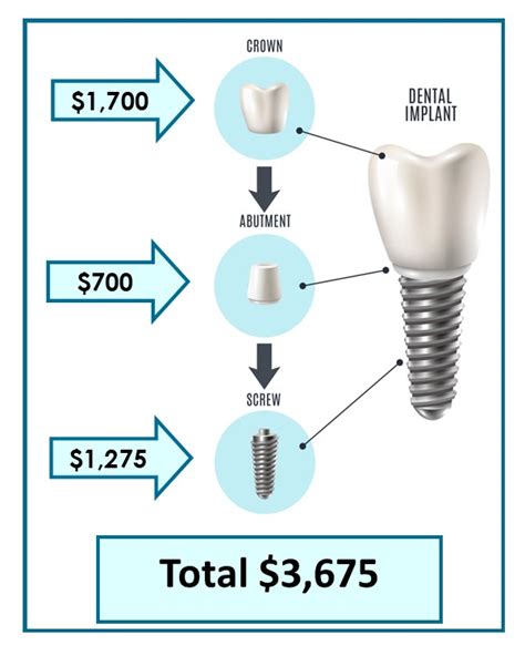 Dental Implant Faqs Total Dentistry Of Cincinnati