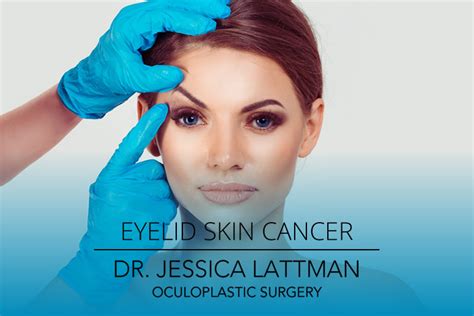 Eyelid Skin Cancer Mohs Reconstruction | New York, NYC | Eyelid Surgeon ...