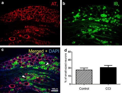 Photomicrographs Showing The Fluorescence AT1 Immunolabeling A And