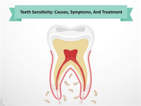 Ppt Teeth Sensitivity Causes Symptoms And Treatment Powerpoint