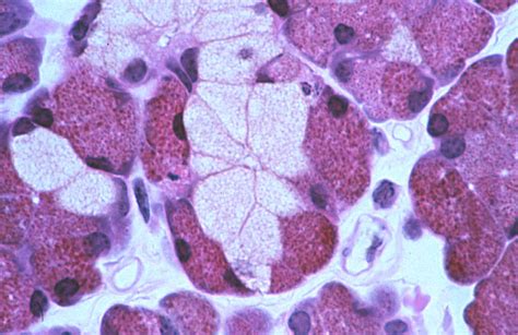 HLS Epithelial Tissue Surface Specializations And Glands Mixed