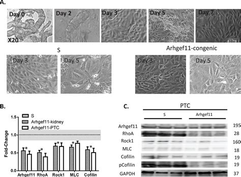 Primary Proximal Tubule Cell Ptc Culture And Arhgef11 Rho Rock Download Scientific Diagram