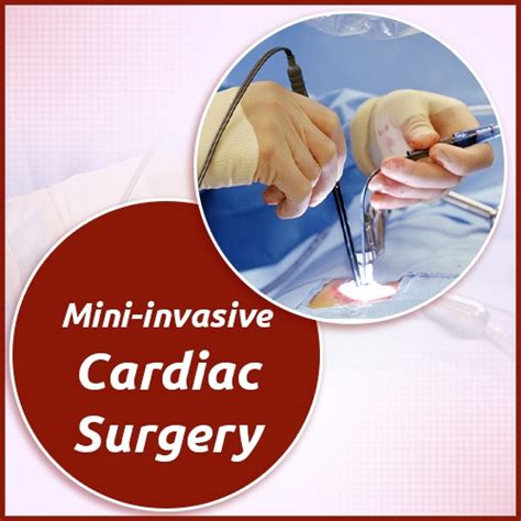 Mini Invasive Cardiac Surgery Dr Ashish Dolas