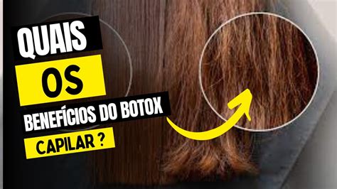 Quais Os Benef Cios Do Botox Capilar Youtube