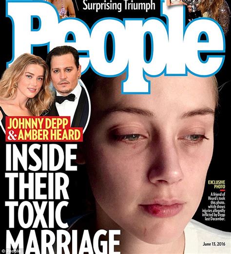 New Photos Show Amber Heard After Johnny Depp Attacked Her In December