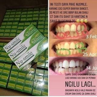 Jual Nu Smile Odol Herbal Ampuh Sembuhkan Sakit Gigi Sariawan Bau Mulut