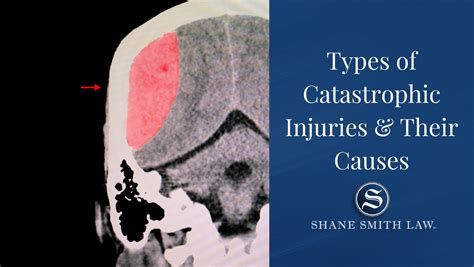 Types Of Catastrophic Injuries And Their Causes